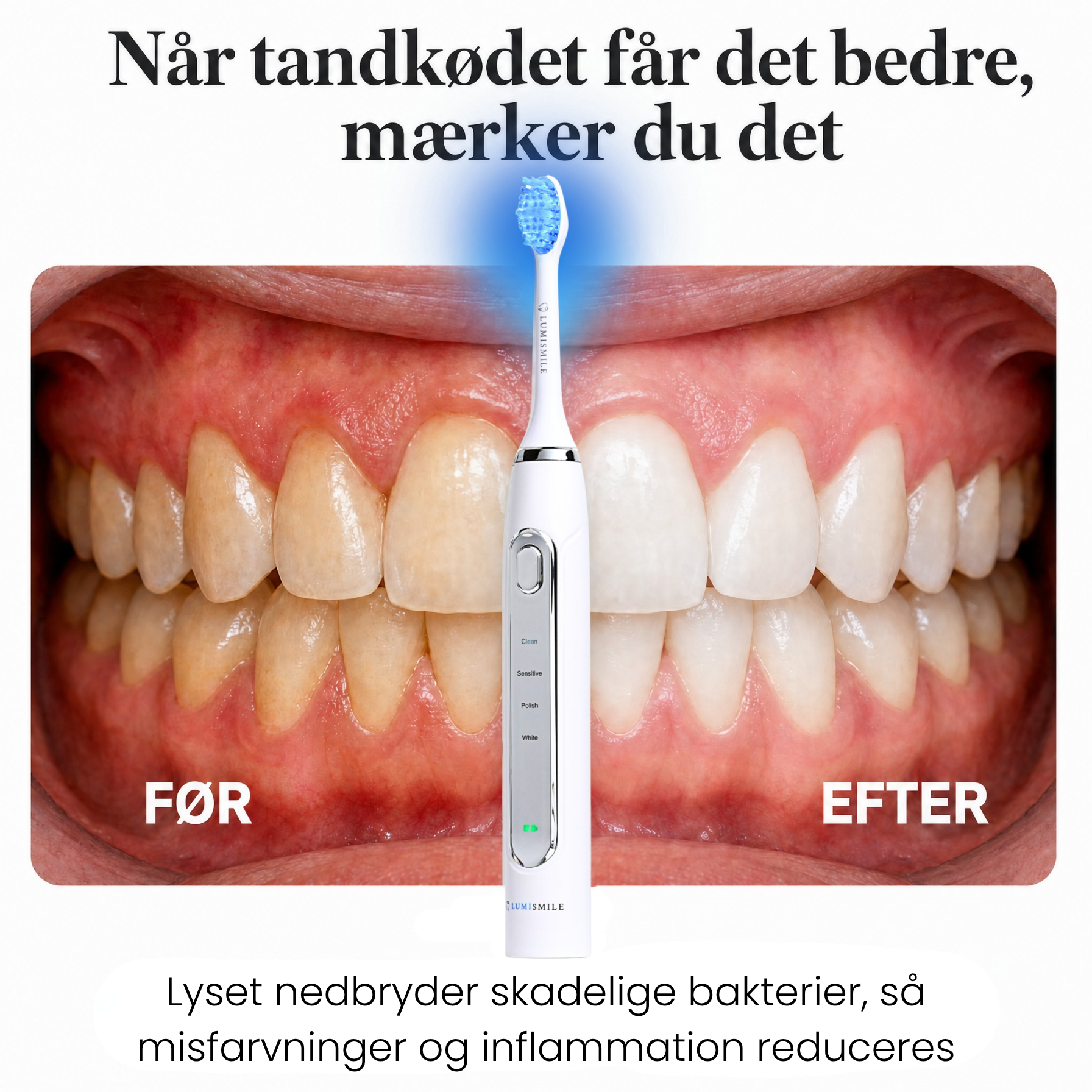 Lumi LED Sonic Brush™