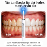 Lumi LED Sonic Brush™