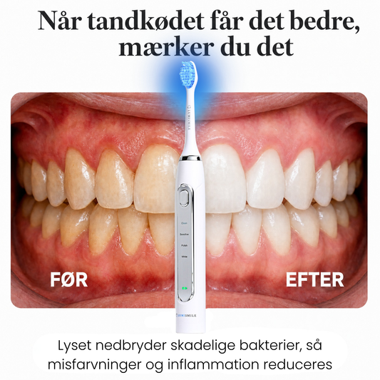 Lumi LED Sonic Brush™