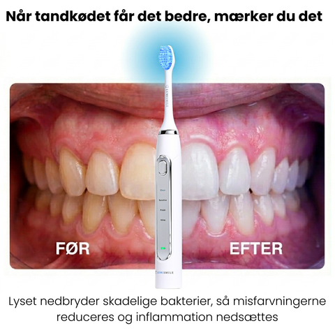 Lumi LED Sonic Brush™