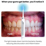 Lumi LED Sonic Brush - English version