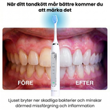 Lumi LED Sonic Brush